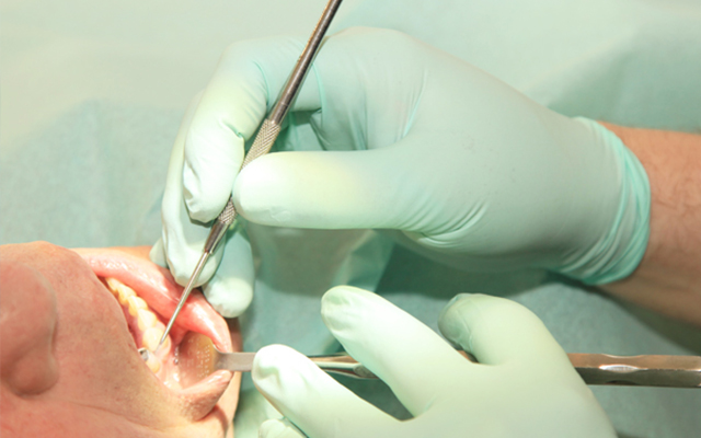 Gingivitis- und Parodontitis-Behandlung